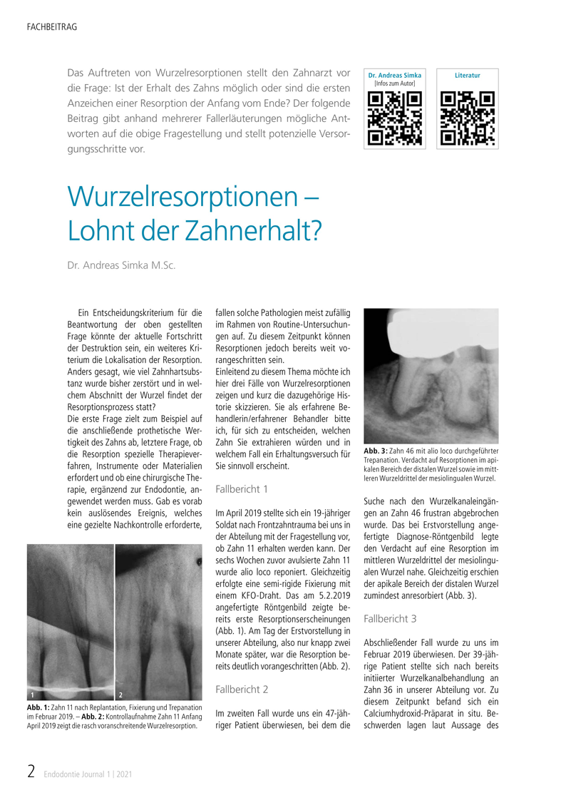 Fachbeitrag von Dr. Andreas Simka: Wurzelresorptionen – Lohnt der Zahnerhalt? Endodontie Journal 1 | 2021