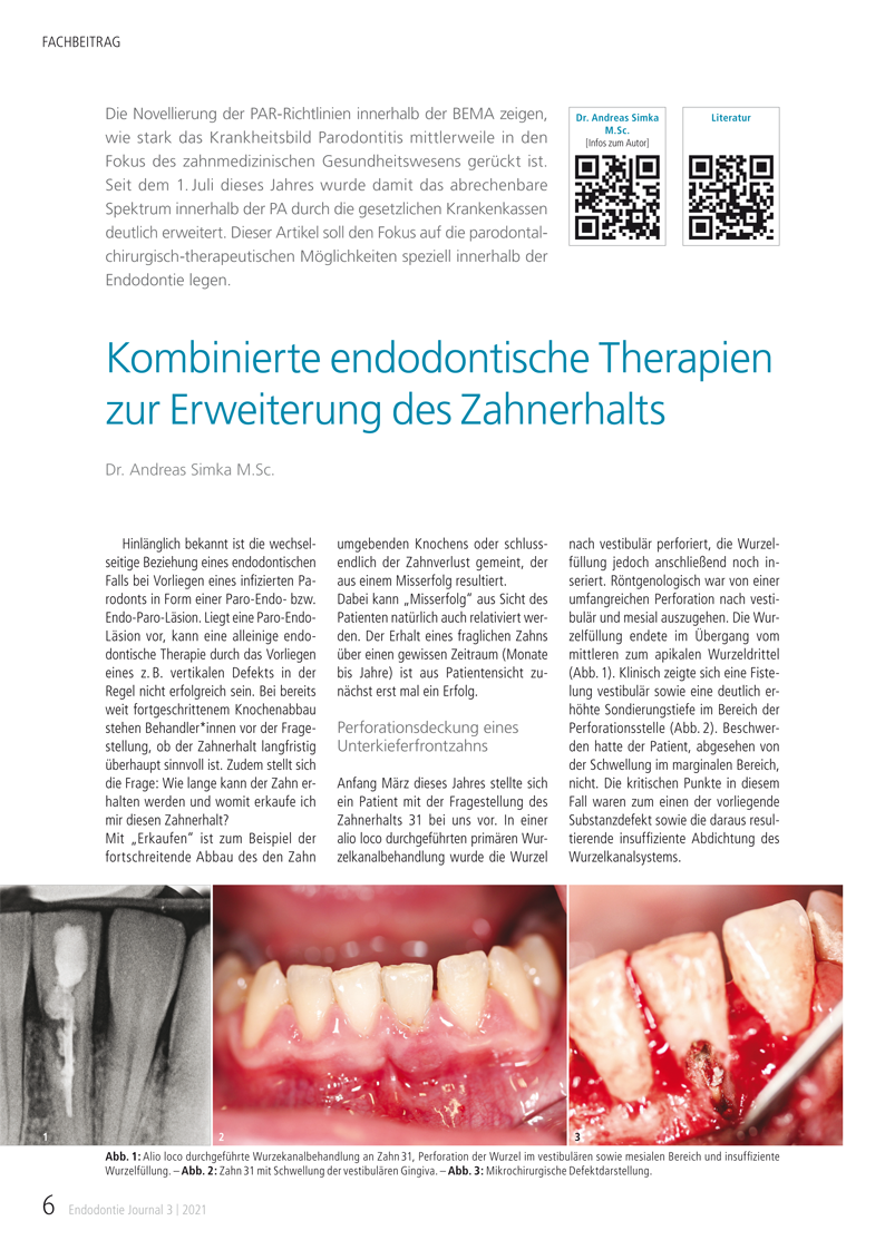 Fachbeitrag von Dr. Andreas Simka: Wurzelresorptionen – Lohnt der Zahnerhalt? Endodontie Journal 3 | 2021