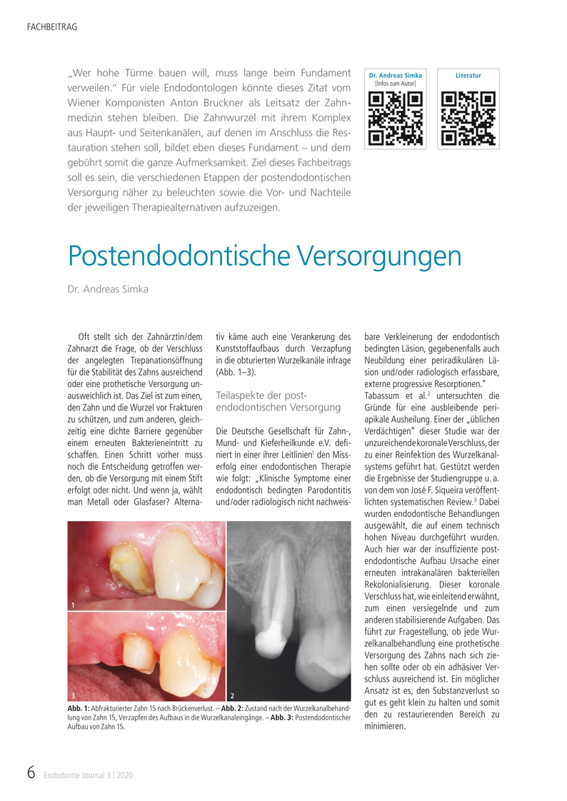 Fachbeitrag von Dr. Andreas Simka: Postendodontische Versorgungen, Endodontie Journal 3 | 2020