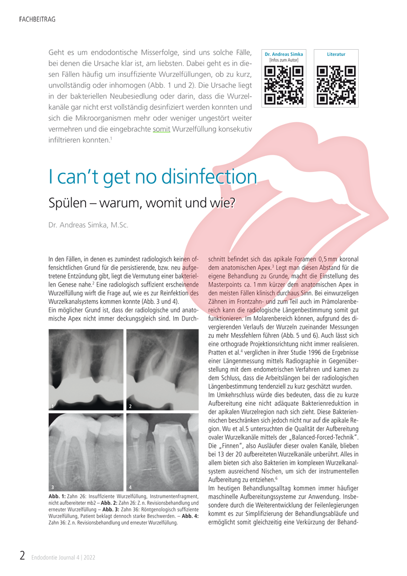 Fachbeitrag von Dr. Andreas Simka: Wurzelresorptionen – Lohnt der Zahnerhalt? Endodontie Journal 4 | 2022